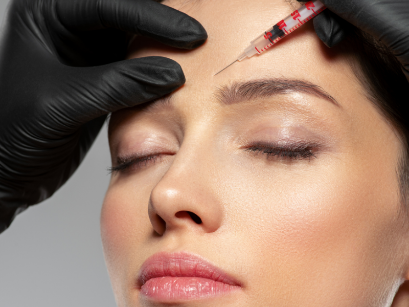 Botox / Toxina Botulínica